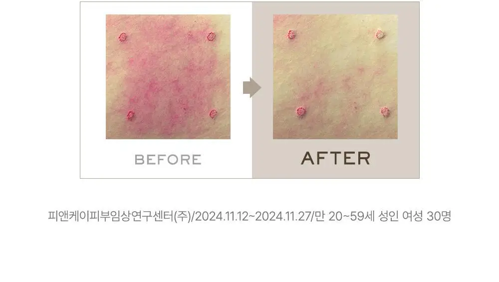 [NEW/백옥광채] 아렌시아 라이스 뮤신 글로우 세럼 30 50g 상세페이지 12